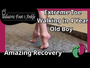 4-Year-Old Boy Undergoes Achilles Tendon Surgery for Severe Toe Walking