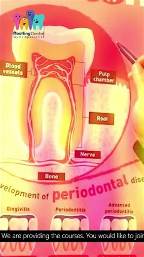 How to prevent tooth To know more check the video now