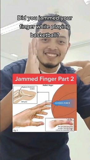 WATCH: This Crazy Jammed Finger Treatment - Now You'll Never Fear Injuries Again!