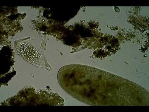 Trachelophyllid ciliate (possibly Trachelophyllum vestitum)