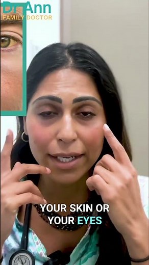 Could This Be a Thyroid Storm? #thyroid