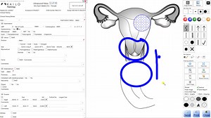 Drawing Surface Tutorial