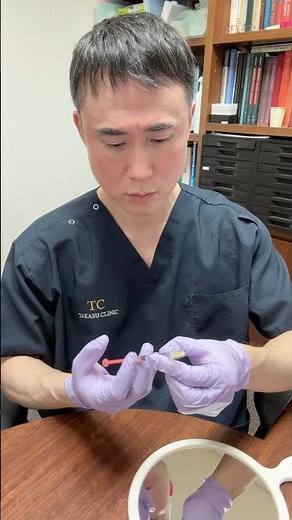 Self-injection of Botox into the corners of the eyes by a beauty guy 💉