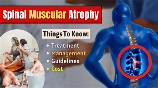 Spinal Muscular Atrophy Treatment And Management Cost, Guidelines And Other Things To Know
