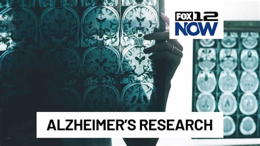 AI Brain Map Shocks Alzheimer’s Research