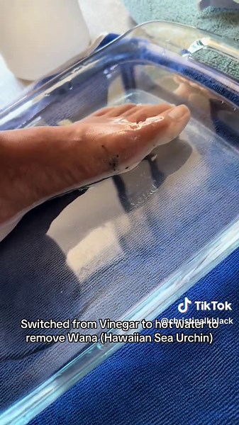 Effective Wana Removal Techniques in Hawaii
