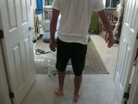 cuboid syndrome Chronic Case Part 2