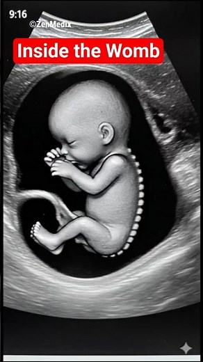 Baby in the Womb: Stunning Ultrasound View 👶✨