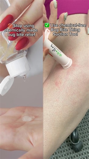 20 reactions |  Stop using chemically-made products for bug bites and start using Bug Bite Thing! A chemical-free and reusable suction tool that quickly alleviates bug bites and stings.烈 No pain, kid-friendly, and 100% money-back guarantee!  Learn more at bugbitething.com #BugBiteThing #BugBiteRelief #BugBites #ChemicalFree #KidFriendly | Bug Bite Thing | Facebook
