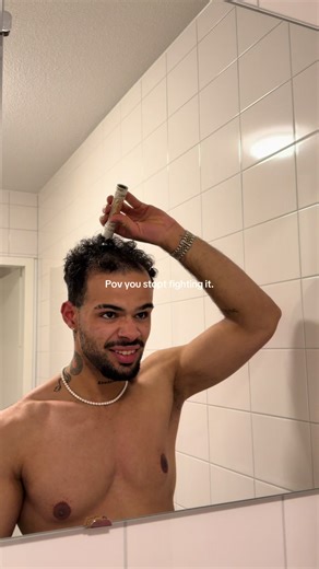 Embrace Your Hair Loss Journey