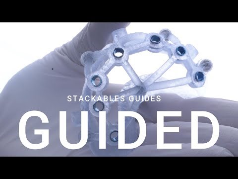 Diseño en Exocad de Prótesis All-on-X para Carga Inmediata con Guías Apilables (stackable guide)