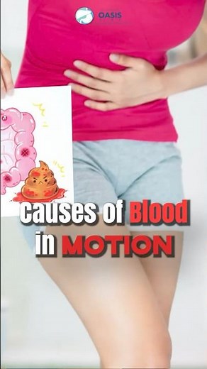 Causes Of Blood In Motion | Dr Aditya Kulkarni #dradityakulkarni #oasisclinic #bloodinmotion #shorts