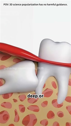 Tooth extraction procedure #drone #theflash #space