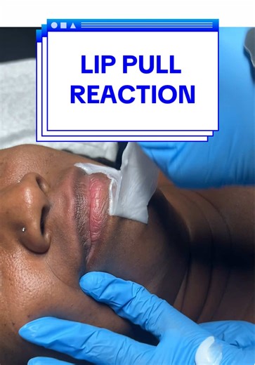 Lip Waxing Reactions with Bushbeads Wax by Bushbalm