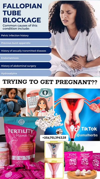 Natural Methods to Unblock Fallopian Tubes for Fertility