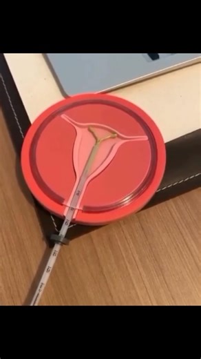 Uni Medical care on Instagram: "👶 Birth control, also known as contraception, is designed to prevent pregnancy. 💊🩹💉⚪🧬🚨 Types include birth control pills, patches, shots, vaginal rings, implants, and emergency contraceptive pills. 🧲🧠 IUCDs, devices which are implanted into the uterus. They can be kept in place for several years. . . . . . . . . #MedicalBreakthroughs #HealthcareHeroes #MedicalResearch #PatientCare #MedicalTechnology #HealthAndWellness #DoctorLife #NursingCare #MedicineInno