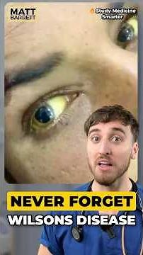 High yield Wilson’s disease facts for your medical exams