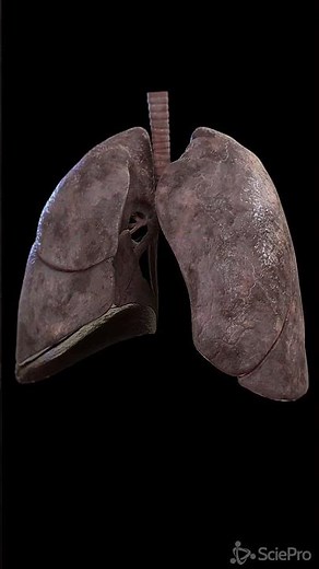 What a smokers lung looks like #anatomy #meded
