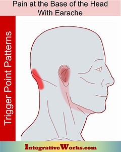 Pain In The Base Of The Head With Earache Cervicogenic Headache