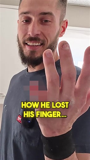 Why table saw safety is so important... #construction #contractor #tablesaw #injury #woodworking