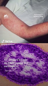 Nueva York declara estado de emergencia sanitaria por sarampión