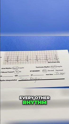 How To Read EKG rhythms pt. 1 #anatomy #sinusrhythm #nursingstudent #monitortech #cardiacmonitoring
