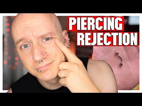 Eyebrow Piercing Removal | Piercing Update | Roly
