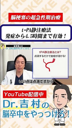t-PA静注療法 発症から4.5時間まで有効！ #脳梗塞 #t-PA静注療法 #脳卒中 #くも膜下出血 #脳出血 #兵庫医科大学 #医学生 #研修医
