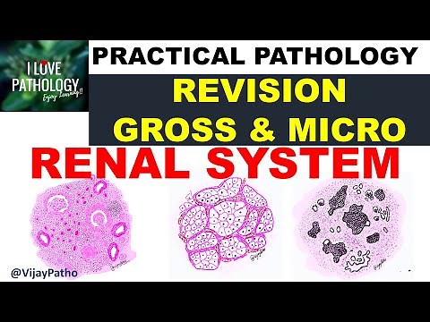 Practical Pathology: Renal system- Chronic pyelonephritis, RCC & Wilms tumor.