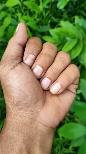 This is jewel beetle or Chrysochroa is a genus of "jewel" or metallic wood boring beetles, typical