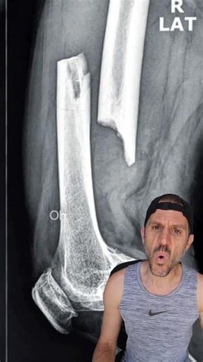 Ben and Mary Bridges on Instagram: "Gen Z is low key cooked no cap, bruh 🤪 #runnersofinstagram #runningtraining #runningmotivation #runninginspiration #marathontraining"