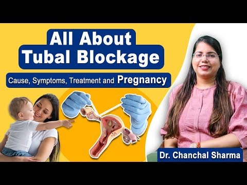 All about Tubal Blockage: Symptoms, Causes, Diagnosis and Natural Treatment - Dr Chanchal Sharma