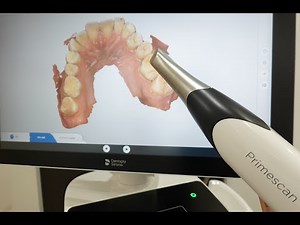 【口腔内スキャナー（プライムスキャン）】赤坂クレール歯科クリニック