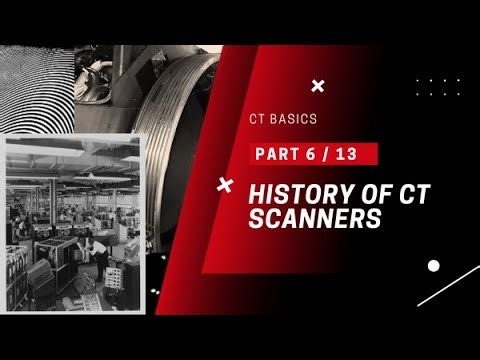 History of CT Scanners