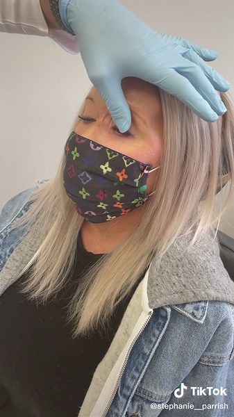 How to put the prosthetic eye in my blind eye #prostheticeye #oneeye #oneeyegang #prosthetic #fyp #foryoupage #foryou #trending #viral #greeneyes