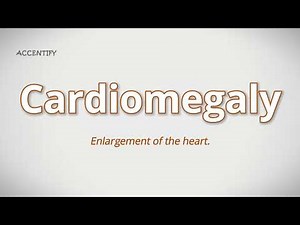 Cardiomegaly (Pronunciation and Meaning)