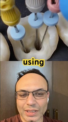 Root Canal Treatment 😳 Does It Hurt?