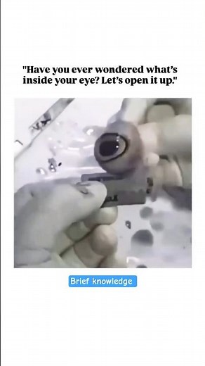 What’s Inside the Human Eye | MBBS Practical Human Eye Dissected | Open the Eye