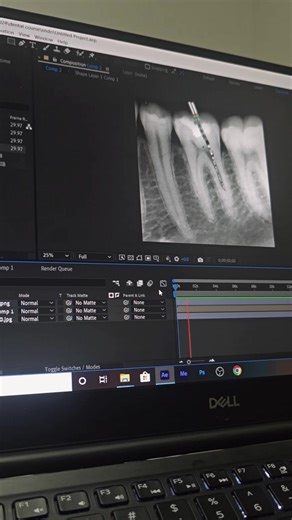 some shots from our course 💥 #dentalmotiongraphic #dentalmotiondesigner #aftereffects #اسنان #طب_اسنان #dentalstudent #dental #dentist #الشعب_الصيني_ماله_حل😂😂