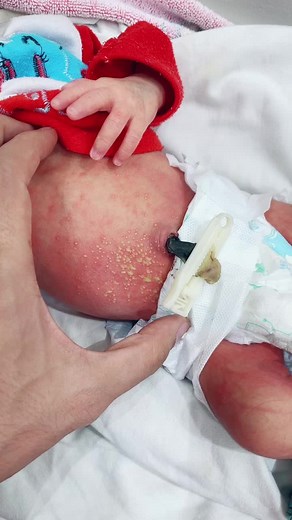 Understanding Hand Wound Care and Recovery