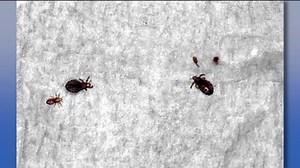 Head lice: How to spot it and get rid of it