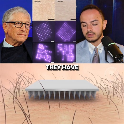 DISTURBING: The Gates Foundation has created microneedle-patch mRNA “vaccines” that PERMANENTLY mark you with quantum-dot QR codes.They are planned to function as a “MARK OF THE BEAST” biological vaccine passport system for the next plandemic.