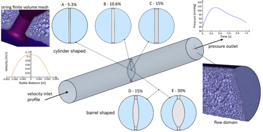 Endovascular structures of the basilar artery as forms of the basilar nonfusion spectrum - Scientific Reports