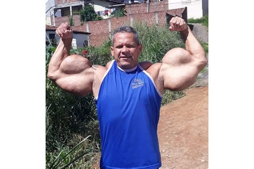 'Brazilian Popeye' dies aged 55 after years of injecting oil into his muscles