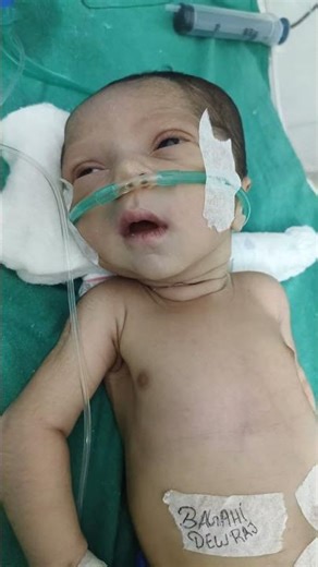 Critical Baby Admitted in NICU 💔 | Newborn Intensive Care. #NICUJourney #BabyCare #StrongBaby