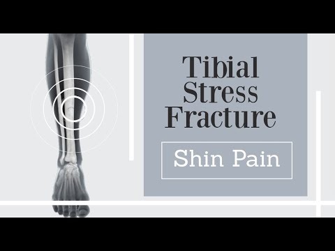 leg pain - front shin pain - tibial stress fracture