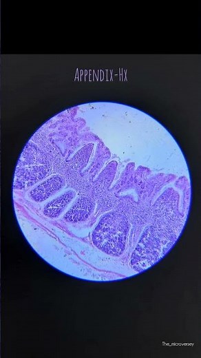 Appendix histology under microscope ‪@TheVside227‬