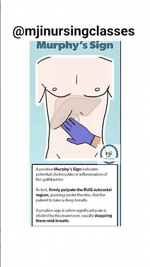 Murphy's sign || Acute Cholecystitis || Gallbladder Inflammation || #cholecystitis