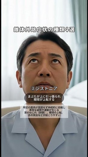錐体外路症状の種類4選