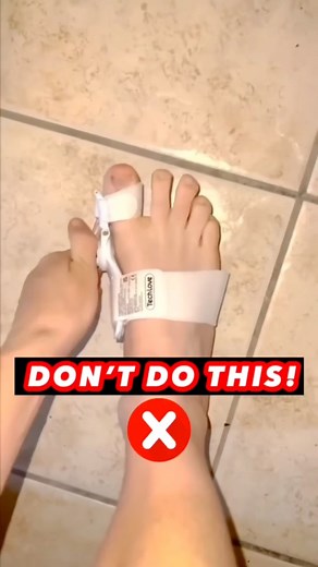 46K views · 643 reactions | Fix your BUNION the natural way!  #bunions #naturalremedies #physicaltherapy | Physical Therapy Session | Facebook